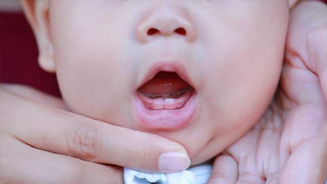 fotos da gengiva do bebê quando vai nascer dente