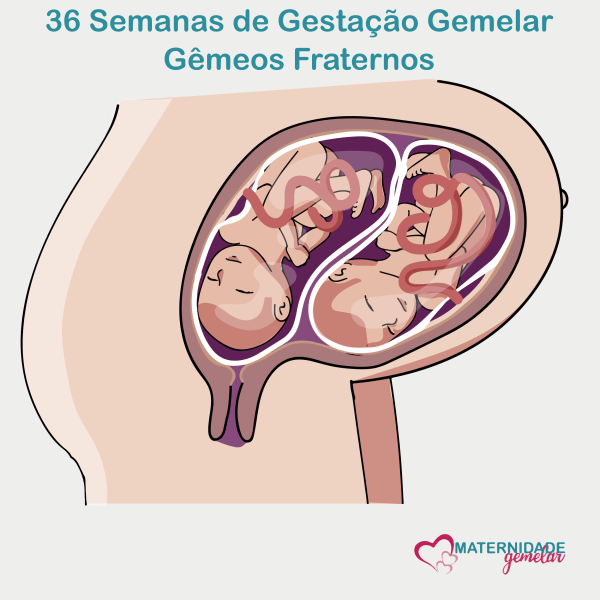 Gravidez Gemeos Semana A Semana Fotos Maternidade And Hospital Octaviano Neves 