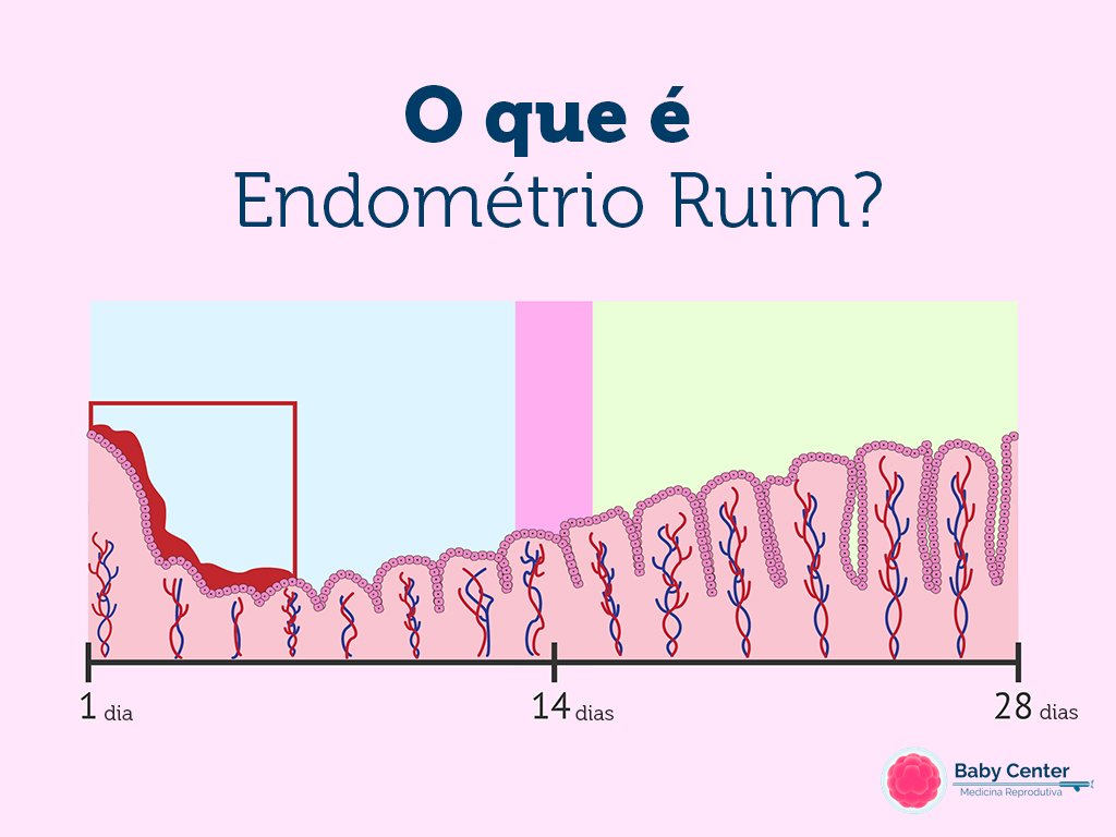 Qual A Espessura Normal Do Endometrio No Inicio Da Gravidez