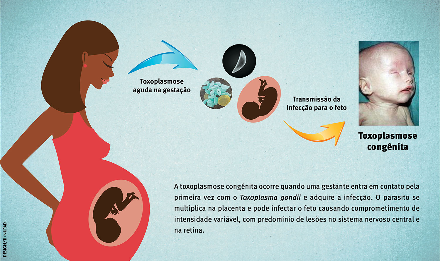 Toxoplasmose Na Gravidez O Que Acontece Com O Bebê